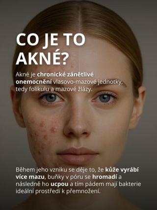 Tuhle skvělou proměnu nám poslala jedna z našich zákaznic a my za ni moc děkujeme!💗 ,,Chtěla jsem vám ukázat změnu po pár...